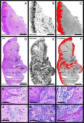 Syndecans and Enzymes for Heparan Sulfate Biosynthesis and Modification Differentially Correlate With Presence of Inflammatory Infiltrate in Periodontitis